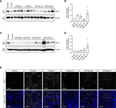 <mark class="highlighted">Variable Expression</mark> of Programmed Cell Death Protein 1-Ligand 1 in Kidneys Independent of Immune Checkpoint Inhibition